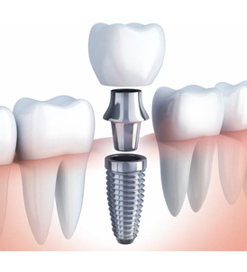 Dr. Sayeh Naem DDS